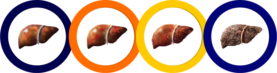 Chronic Liver Stages