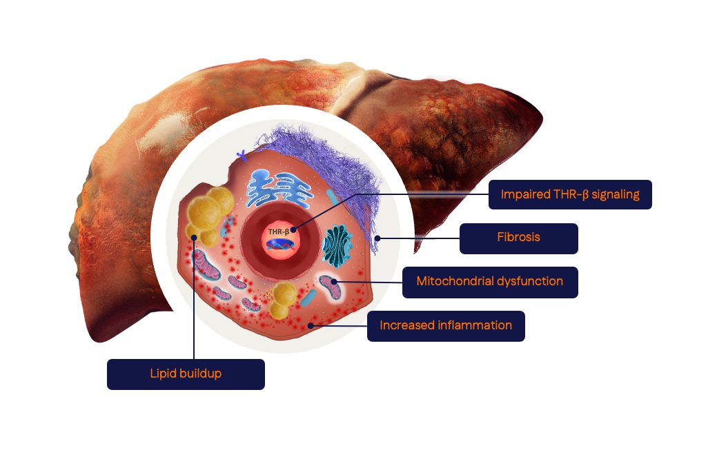 role of thyroid updated